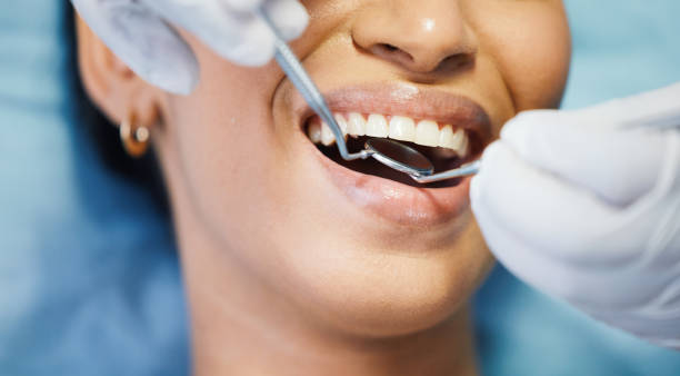 Best Emergency Dental Care for Sports Injuries in Bonny Doon, CA