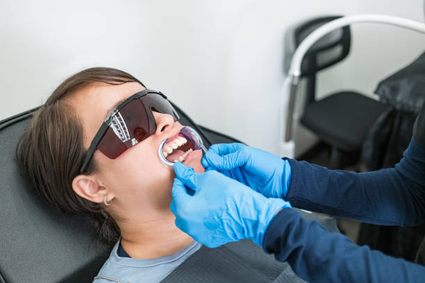 Best Knocked-Out Tooth (Avulsed Tooth) Treatment in Bonny Doon, CA