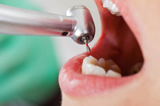 Best Emergency Pediatric Dental Care in Bonny Doon, CA